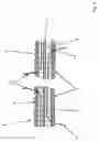 Fig. 05 - Micro-spiral implantation device