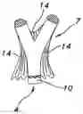 Fig. 01 - Multi-furcated ePTFE grafts and stent-graft prostheses and methods of making the same