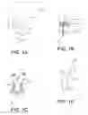 Fig. 02 - Multi-furcated ePTFE grafts and stent-graft prostheses and methods of making the same