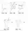 Fig. 12 - Multi-furcated ePTFE grafts and stent-graft prostheses and methods of making the same