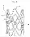 Fig. 03 - Flexible stent