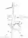 Fig. 02 - Method and apparatus for reducing mitral regurgitation