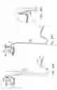 Fig. 43 - Method and apparatus for reducing mitral regurgitation