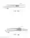 Fig. 76 - Method and apparatus for reducing mitral regurgitation