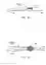Fig. 79 - Method and apparatus for reducing mitral regurgitation