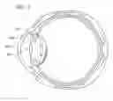 Fig. 03 - Piggyback lenses