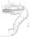 Fig. 05 - Use of biosurgical adhesive on inflatable device for gastric restriction