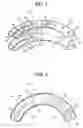 Fig. 02 - Artificial-Intervertebral-Disk Insertion Jigs, Jig Set, And Artificial Intervertebral Disk