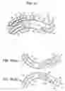 Fig. 09 - Artificial-Intervertebral-Disk Insertion Jigs, Jig Set, And Artificial Intervertebral Disk