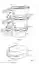 Fig. 02 - System and method for sizing, inserting and securing artificial disc in intervertebral space