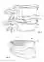 Fig. 04 - System and method for sizing, inserting and securing artificial disc in intervertebral space