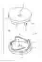 Fig. 04 - Corpectomy vertebral body replacement implant system
