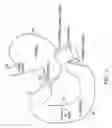 Fig. 02 - Methods of treatment using a bariatric sleeve