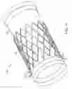 Fig. 05 - Methods of treatment using a bariatric sleeve