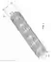 Fig. 09 - Methods of treatment using a bariatric sleeve