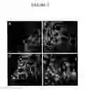 Fig. 08 - Methods For The Modulation of Oleosin Expression In Plants