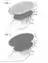 Fig. 03 - Motorized personal skin care implement