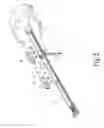 Fig. 03 - Rail assembly for slide-type garage door