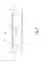 Fig. 06 - Rail assembly for slide-type garage door