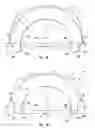 Fig. 02 - Air no air elastomeric tire