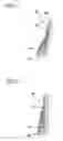 Fig. 02 - Method Of Forming Bead Filler