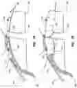 Fig. 08 - Cinch ring for tightening tethers of an inflatable airbag