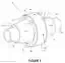Fig. 02 - Doubled-up pipe coupling