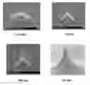 Fig. 23 - Vertical Microprobes for Contacting Electronic Components and Method for Making Such Probes