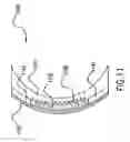 Fig. 09 - ELECTRO-OPTIC LENS WITH INTEGRATED COMPONENTS FOR VARYING REFRACTIVE PROPERTIES