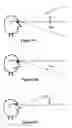 Fig. 49 - ELECTRO-OPTIC LENS WITH INTEGRATED COMPONENTS FOR VARYING REFRACTIVE PROPERTIES