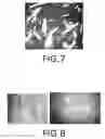 Fig. 07 - METHODS FOR VISUALIZING CRYSTALS AND DISTINGUISHING CRYSTALS FROM OTHER MATTER WITHIN A BIOLOGICAL SAMPLE