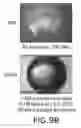Fig. 09 - METHODS FOR VISUALIZING CRYSTALS AND DISTINGUISHING CRYSTALS FROM OTHER MATTER WITHIN A BIOLOGICAL SAMPLE
