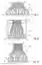 Fig. 07 - Redistribution interconnect for microbeamforming(s) and a medical ultrasound system