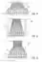 Fig. 09 - Redistribution interconnect for microbeamforming(s) and a medical ultrasound system