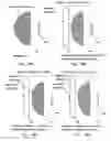 Fig. 11 - Objective lens optical system