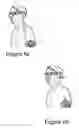 Fig. 09 - Recreational bone conduction audio device, system