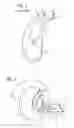 Fig. 02 - Behind-the-ear hearing device having an external, optical microphone