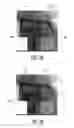 Fig. 06 - System and method for structure enhancement and noise reduction in medical images