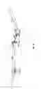 Fig. 17 - Wave forming apparatus and method