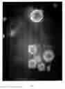 Fig. 02 - Cultures of human CNS neural stem cells
