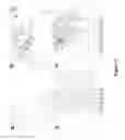 Fig. 03 - Tr1 cells for use in atherosclerosis