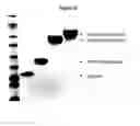 Fig. 10 - Modified Human Growth Hormone