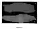 Fig. 05 - Compositions and methods for topical application and transdermal delivery of botulinum toxins