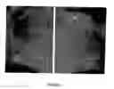 Fig. 06 - Compositions and methods for topical application and transdermal delivery of botulinum toxins