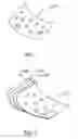 Fig. 02 - Bioabsorbable Implantable Material Fortified with Antibiotics for Localized Delivery of Drugs