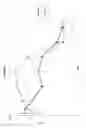 Fig. 06 - Ocular implant made by a double extrusion process