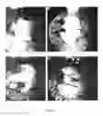 Fig. 04 - USE OF A VECTOR COMPRISING A NUCLEIC ACID ENCODING AN ANTI-ANGIOGENIC FACTOR FOR THE TREATMENT OF CORNEAL NEOVASCULARIZATION