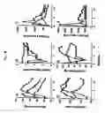 Fig. 07 - Method of inhibiting side effects of pharmaceutical compositions containing amphiphilic vehicles or drug carrier molecules