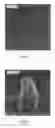 Fig. 06 - Method for synthesizing nanoscale structures in defined locations