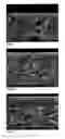 Fig. 02 - Multi-Layer Coated Products and Curtain Coating Process for Same